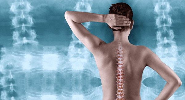 osteoporoza-tihi-kradlivats-kostiju